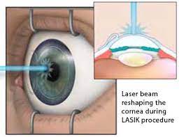 cal uses of the laser beams