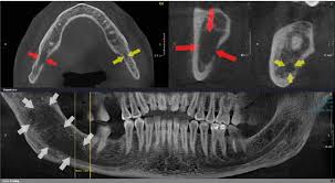 cone beam computed tomographic images