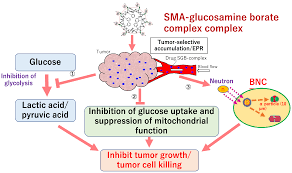 radiation therapy