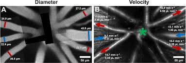 Imaging Single Cell Blood Flow In The