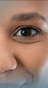Alcon Eye Care For Healthcare