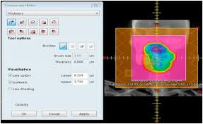 3d treatment planning system varian