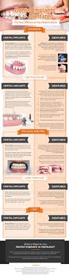 dental implants vs dentures which one