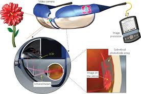 photovoltaic retinal prosthesis with
