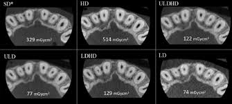 cone beam computed tomography