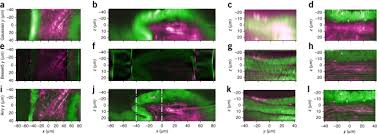 light sheet microscopy using an airy