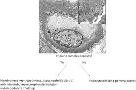 Diagnosis Of Glomerular Disease With