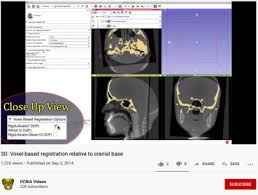 cone beam ct scans for orthodontic