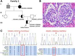 Col4a4 Mutations Identified In Family 1