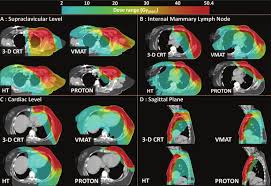 photon proton treatment planning