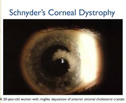 Ocular Disease 1 Disorders Of The