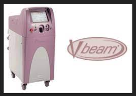 v beam laser treatment by dr u