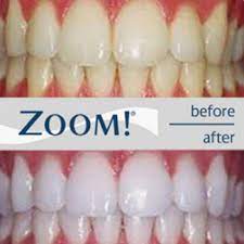 zoom whitening midland park wyckoff nj