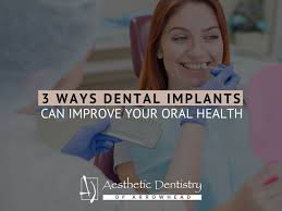 3 ways dental implants can improve your