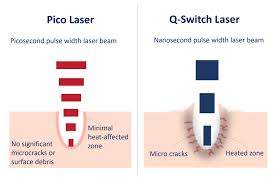 pico laser treatment