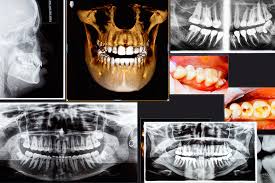 3d cone beam computed tomography scan