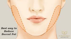 how to reduce face fat buccal fat