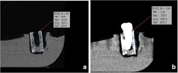 cone beam computed tomography