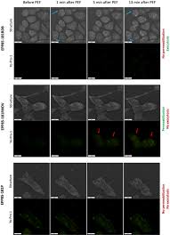 Nanosecond Pulsed Electric Field