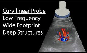 Ultrasound Machine Basics Knobology