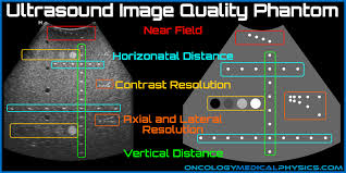 Ultrasound Image Quality Oncology