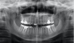 imagerie dentaire cone beam et
