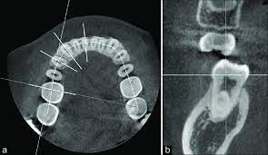 cone beam computed tomography images