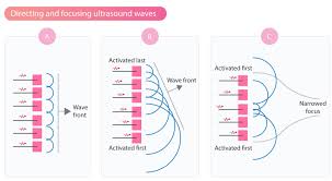 technical aspects of the ultrasound