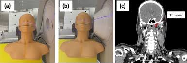 neutron beam collimation