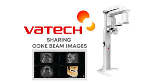 how to export dental cone beam scans