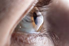 Corneal Disease Greenville Clemson Eye