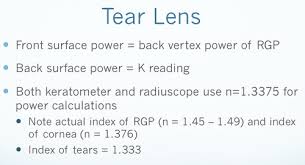 6 2b Single Vision Contact Lenses Rgp