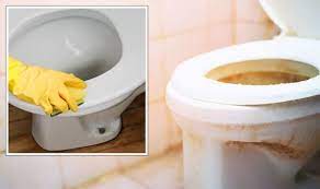 Remove Yellow Stains From Toilet Seats