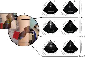 flexible ultrasound transceiver array