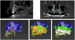 cone beam computed tomography and its