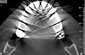 cone beam computed tomography cbct