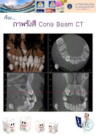 ภาพร งส cone beam ct คณะท นตแพทยศาสตร
