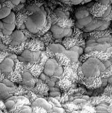 what is electron microscopy umass