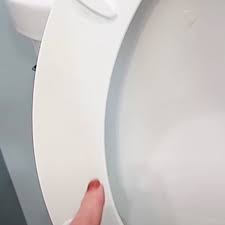 Yellow Stains From The Toilet Seat And Lid