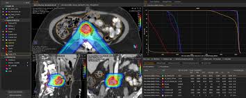 proton therapy case stus