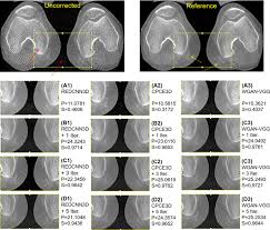 cone beam ct