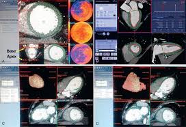 sment of cardiac function