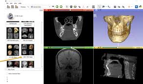 searching for cbct scans