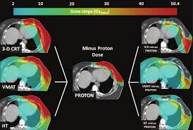 photon proton treatment planning