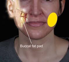 buccal fat removal by san go plastic