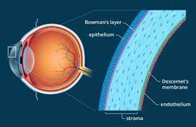 Corneal Disease Treatment In Bellingham