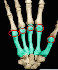 x ray beam flashcards quizlet