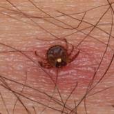 Image result for Trombicula autumnalis bites