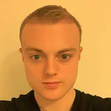 Chris Durbin's Hair Transplant Success: Defying Baldness