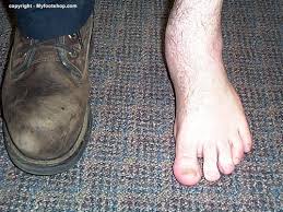 We did not find results for: Posterior Tibial Tendon Dysfunction Pttd Causes And Treatment Options Myfootshop Com